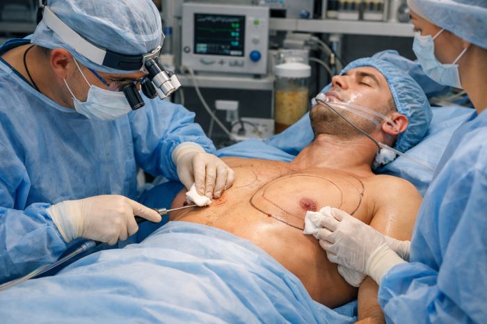 Ложная гинекомастия