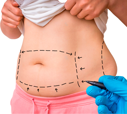 Пластика после родов