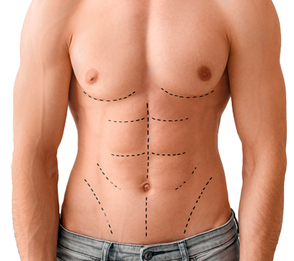 Мужская пластика