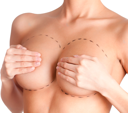 Маммопластика Маммопластика